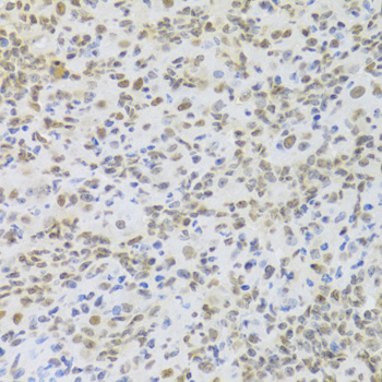 Rabbit anti-HMGB1 Polyclonal Antibody