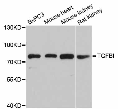 Rabbit anti-TGFBI Polyclonal Antibody