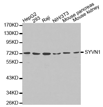 Rabbit anti-SYVN1 Polyclonal Antibody
