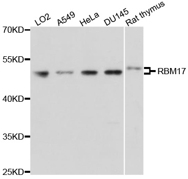 Rabbit anti-RBM17 Polyclonal Antibody