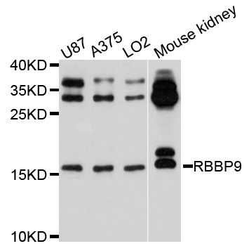Rabbit anti-RBBP9 Polyclonal Antibody