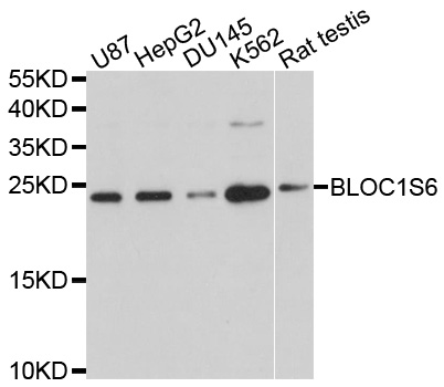 Rabbit anti-BLOC1S6 Polyclonal Antibody