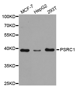 Rabbit anti-PSRC1 Polyclonal Antibody