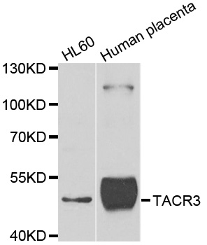 Rabbit anti-TACR3 Polyclonal Antibody