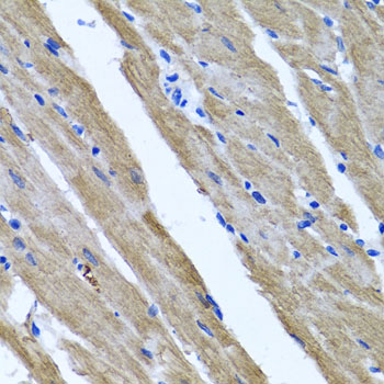 Rabbit anti-DFNA5 Polyclonal Antibody