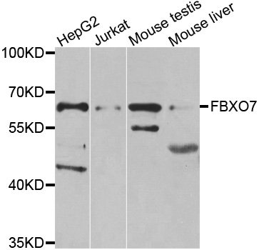 Rabbit anti-FBXO7 Polyclonal Antibody