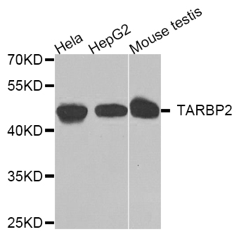 Rabbit anti-TARBP2 Polyclonal Antibody