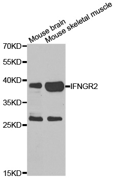 Rabbit anti-IFNGR2 Polyclonal Antibody