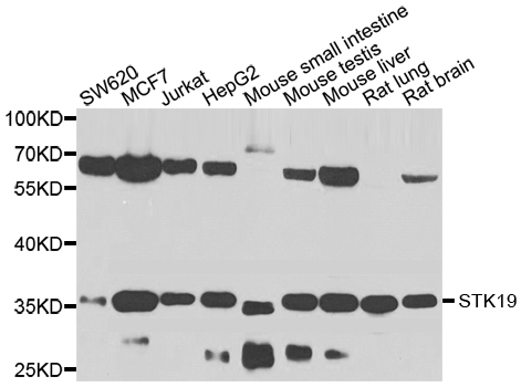 Rabbit anti-STK19 Polyclonal Antibody
