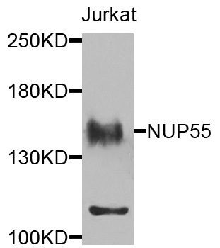 Rabbit anti-NUP155 Polyclonal Antibody