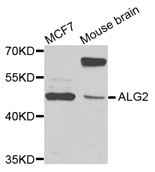 Rabbit anti-ALG2 Polyclonal Antibody