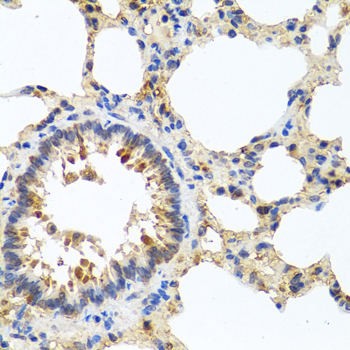 Rabbit anti-LRG1 Polyclonal Antibody