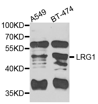Rabbit anti-LRG1 Polyclonal Antibody