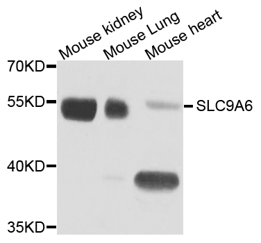 Rabbit anti-SLC9A6 Polyclonal Antibody
