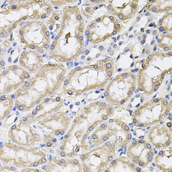 Rabbit anti-RNF166 Polyclonal Antibody