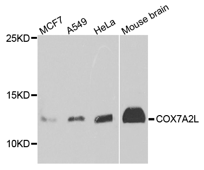 Rabbit anti-COX7A2L Polyclonal Antibody
