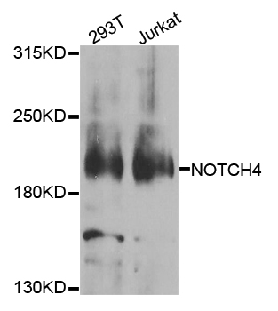 Rabbit anti-NOTCH4 Polyclonal Antibody