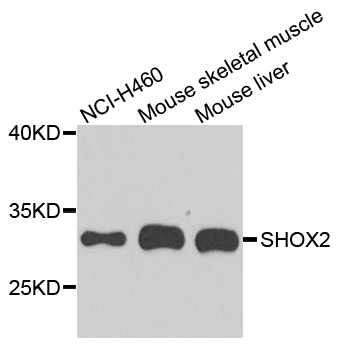 Rabbit anti-SHOX2 Polyclonal Antibody
