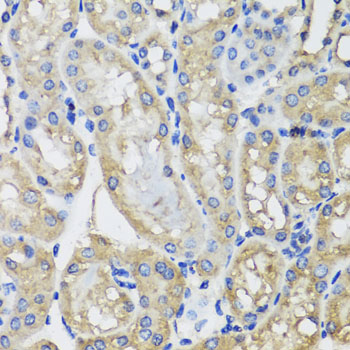 Rabbit anti-MRPS22 Polyclonal Antibody