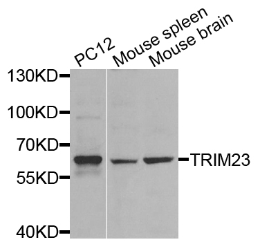 Rabbit anti-TRIM23 Polyclonal Antibody