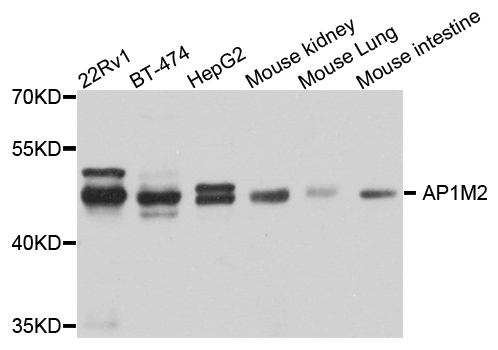 Rabbit anti-AP1M2 Polyclonal Antibody