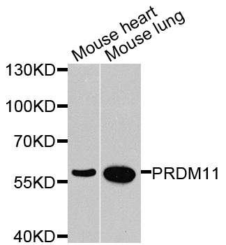 Rabbit anti-PRDM11 Polyclonal Antibody