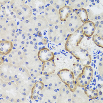 Rabbit anti-MTERFD3 Polyclonal Antibody