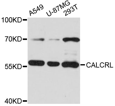 Rabbit anti-CALCRL Polyclonal Antibody
