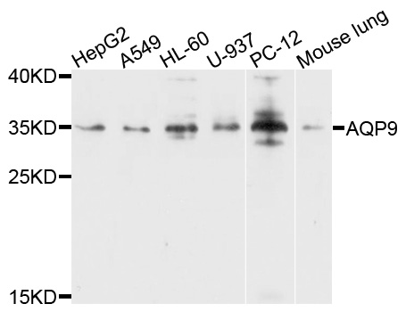 Rabbit anti-AQP9 Polyclonal Antibody