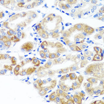 Rabbit anti-DLG1 Polyclonal Antibody