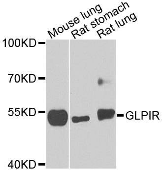 Rabbit anti-GLP1R Polyclonal Antibody