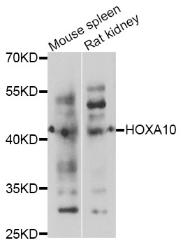 Rabbit anti-HOXA10 Polyclonal Antibody