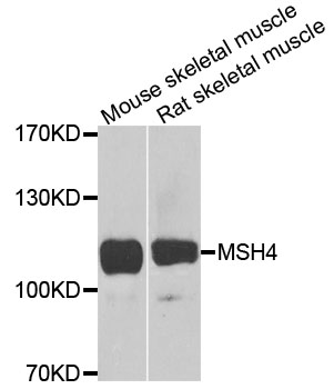 Rabbit anti-MSH4 Polyclonal Antibody