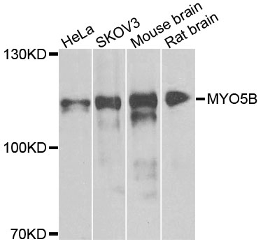 Rabbit anti-MYO5B Polyclonal Antibody