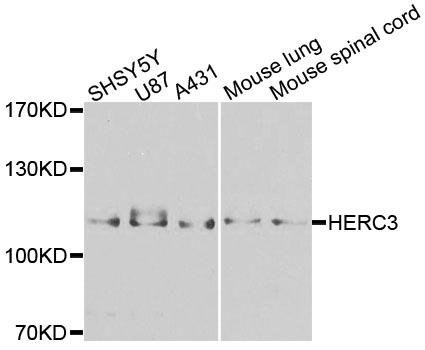 Rabbit anti-HERC3 Polyclonal Antibody