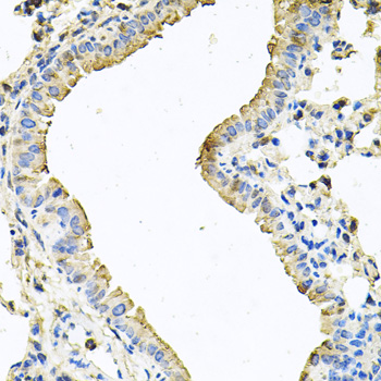 Rabbit anti-CHCHD3 Polyclonal Antibody