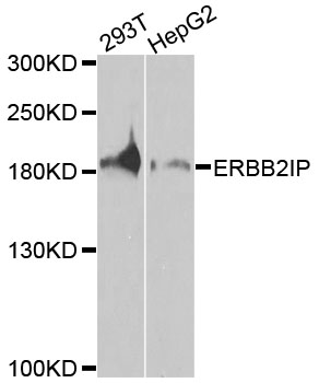 Rabbit anti-ERBB2IP Polyclonal Antibody