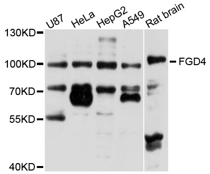 Rabbit anti-FGD4 Polyclonal Antibody