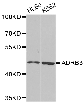 Rabbit anti-ADRB3 Polyclonal Antibody