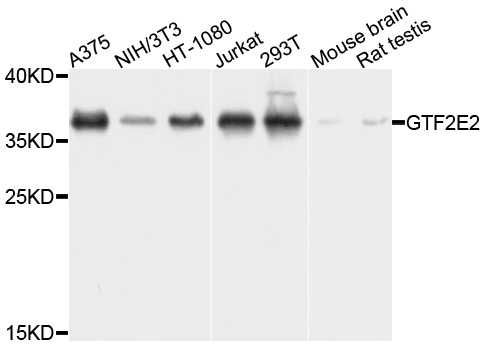 Rabbit anti-GTF2E2 Polyclonal Antibody