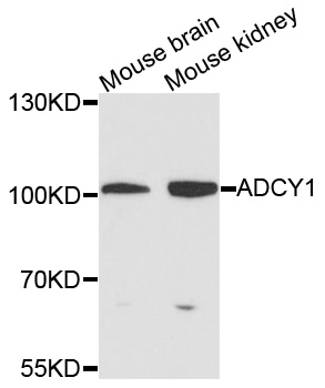 Rabbit anti-ADCY1 Polyclonal Antibody