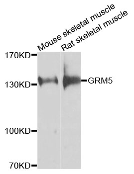 Rabbit anti-GRM5 Polyclonal Antibody