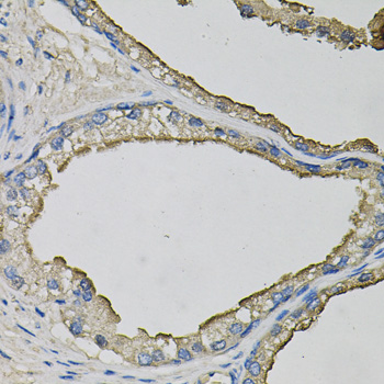 Rabbit anti-LCN1 Polyclonal Antibody