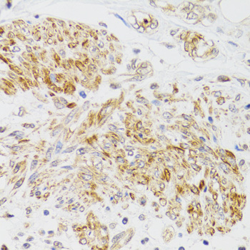 Rabbit anti-MYO5A Polyclonal Antibody