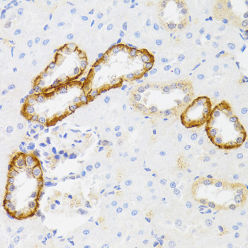 Rabbit anti-MYO5A Polyclonal Antibody