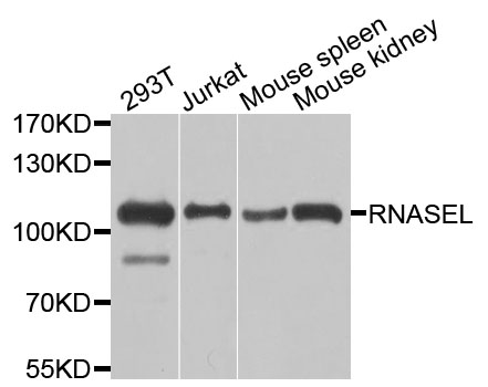 Rabbit anti-RNASEL Polyclonal Antibody