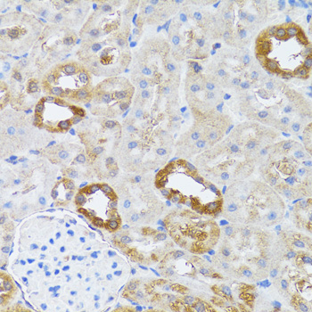 Rabbit anti-RNASEL Polyclonal Antibody