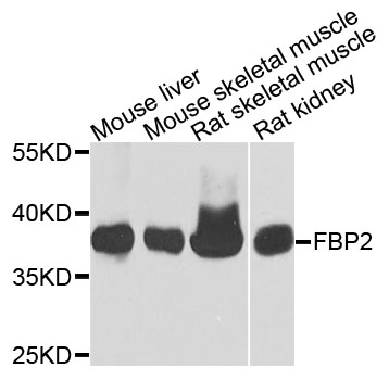 Rabbit anti-FBP2 Polyclonal Antibody