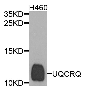 Rabbit anti-UQCRQ Polyclonal Antibody