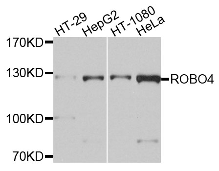 Rabbit anti-ROBO4 Polyclonal Antibody